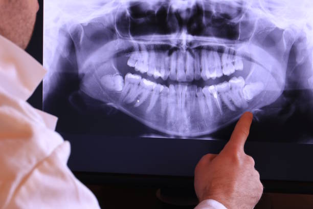 Best Emergency Broken Tooth Repair in Bellefonte, PA